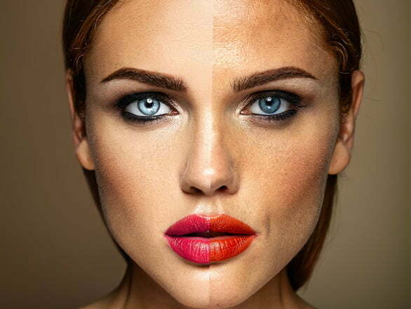 peeling quimico peeling quimico facial madrid rejuvenecimiento facial