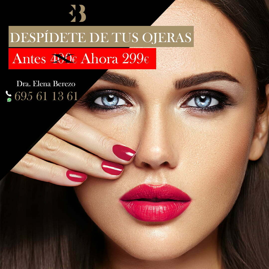 eliminar ojeras medicina estética madrid