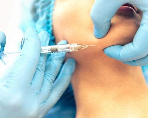 aumento de mentón sin cirugía medicina estética madrid