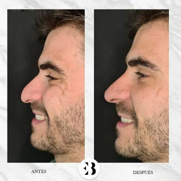 rinomodelacion madrid