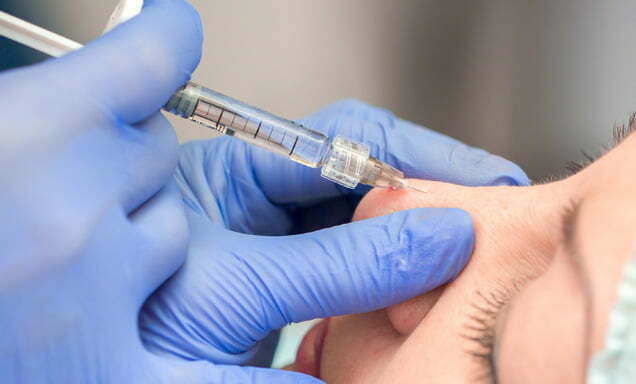 rinomodelación sin cirugía nariz aguileña