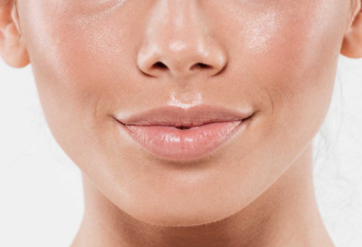 aumento de mentón Medicina estética Velázquez