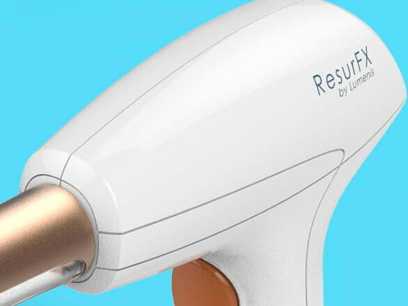 resurfacing facial Madrid