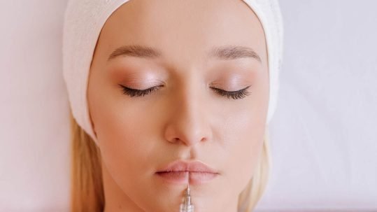 aumento de labios con acido hialuronico