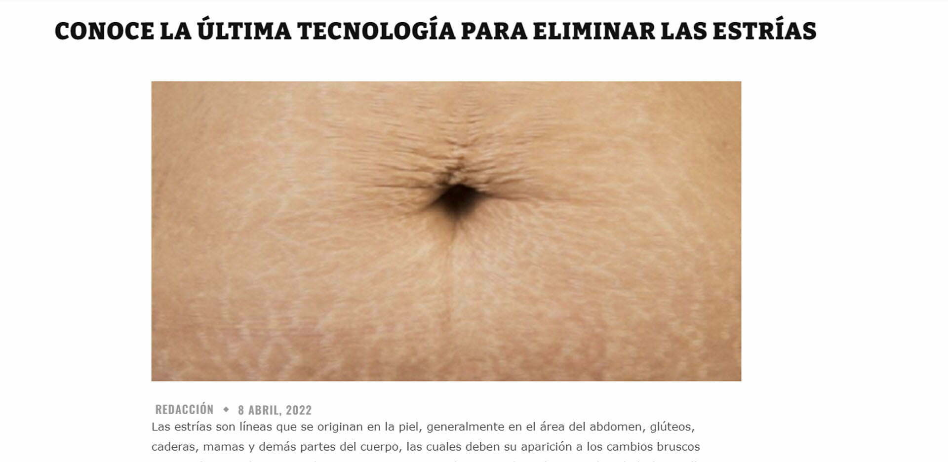 dr elena berezo periodico Qué