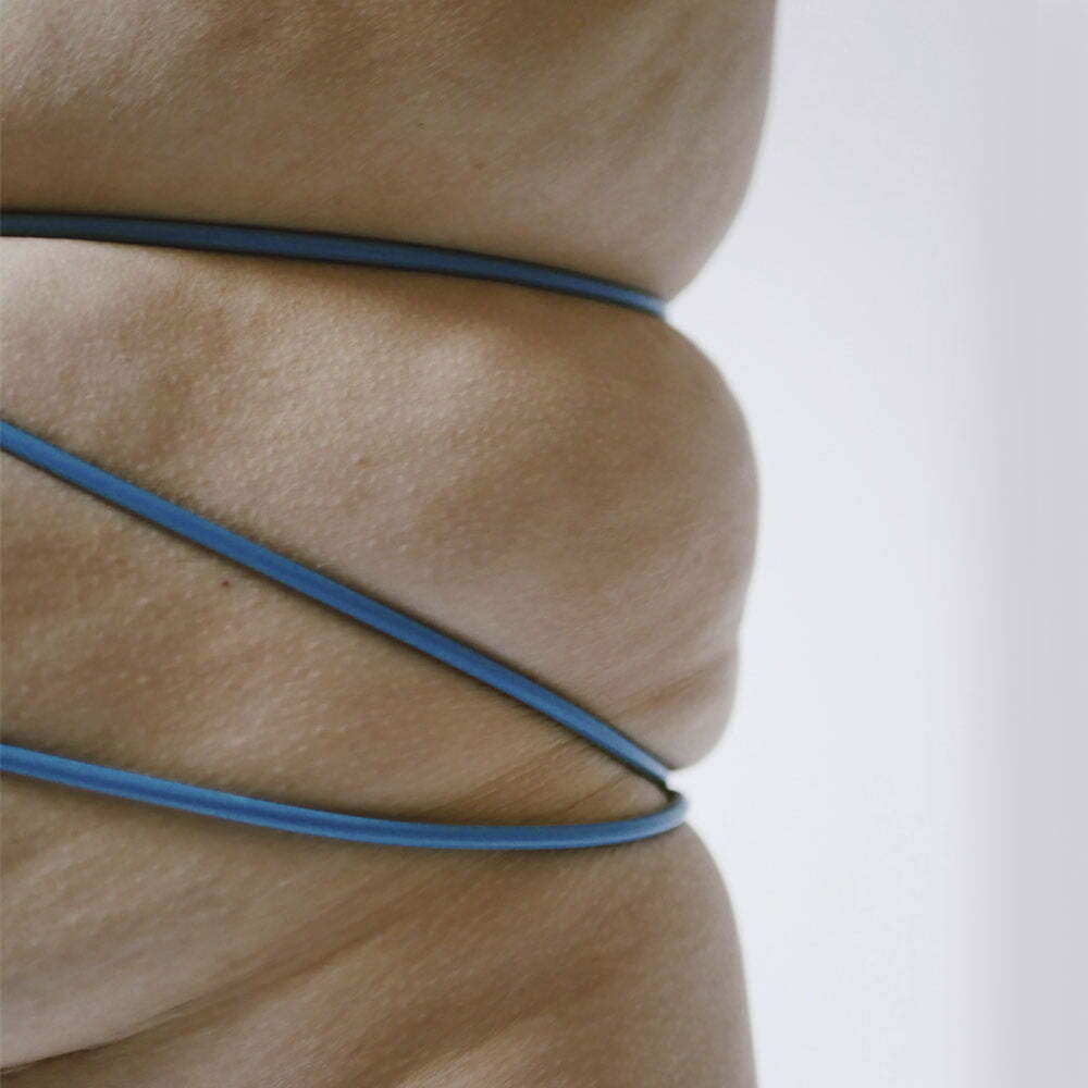 Qué es la intralipoterapia y en qué zonas del cuerpo se aplica