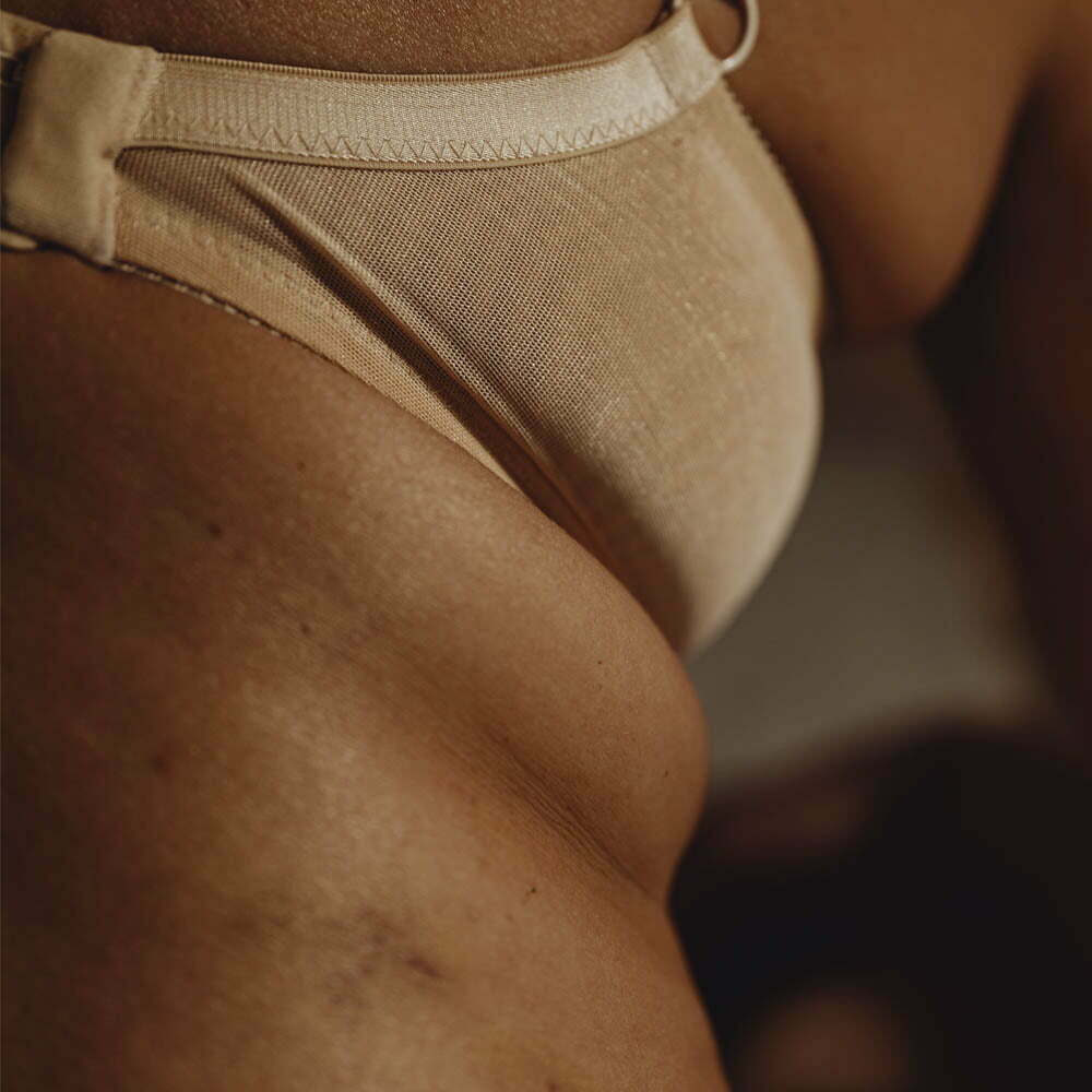 alidya antes y después