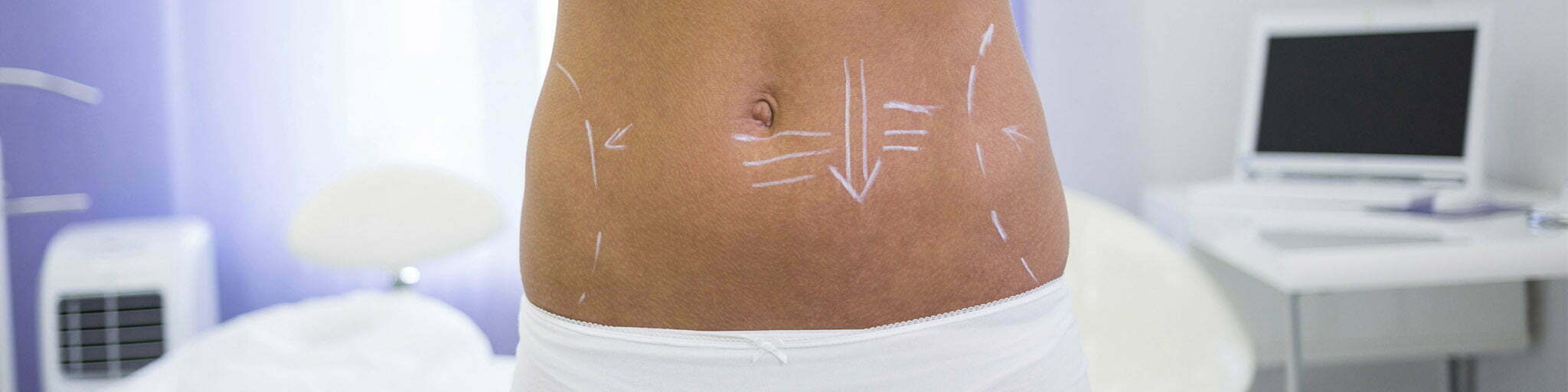 intralipoterapia que es