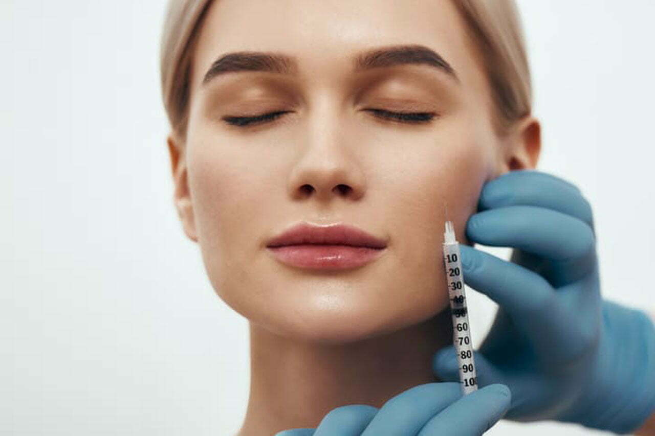 Relleno de pómulos: Antes y después