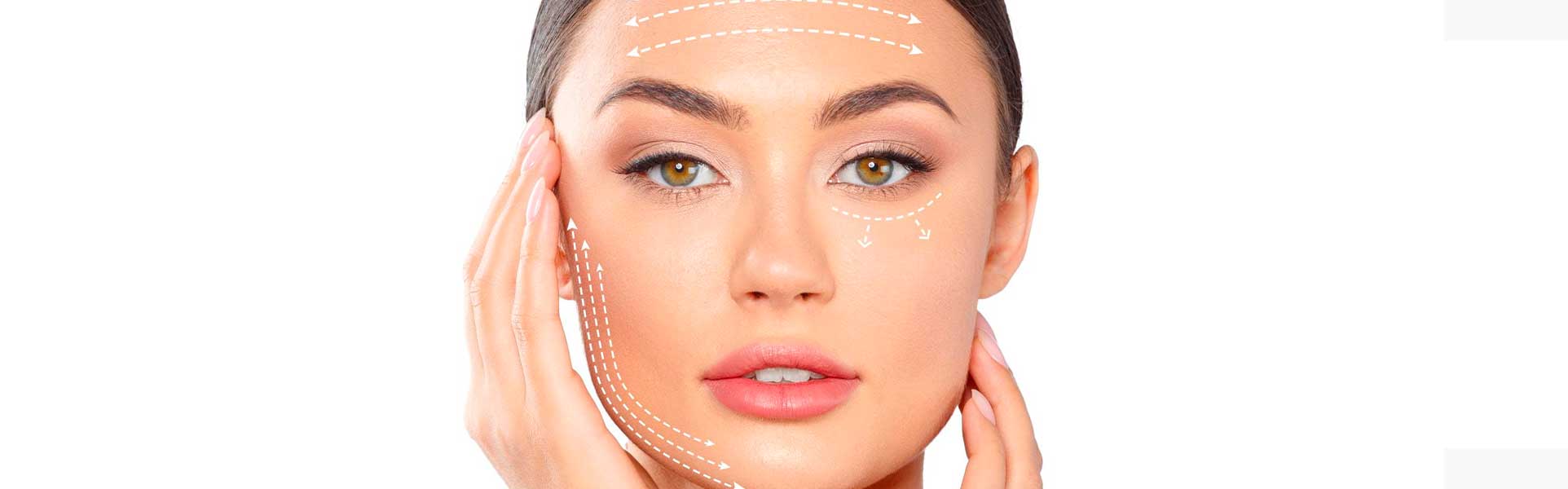 hilos tensores desventajas