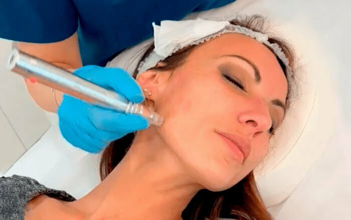 Laila en la Clínica Medicina Estética Velazquez