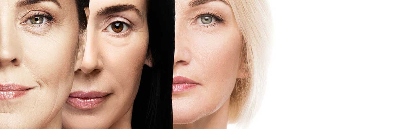 resurfacing con lumenis m22