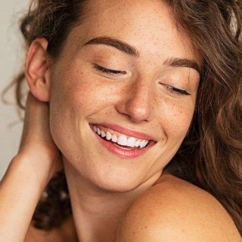 marcación mandibular con acido hialuronico