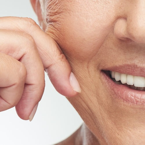 Relleno de pómulos con acido hialurónico