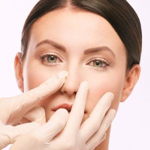 Rinomodelación sin Cirugía en la clinica de medicina estetica EB en Madrid