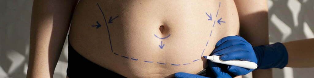 zonas para eliminar la grasa localizada