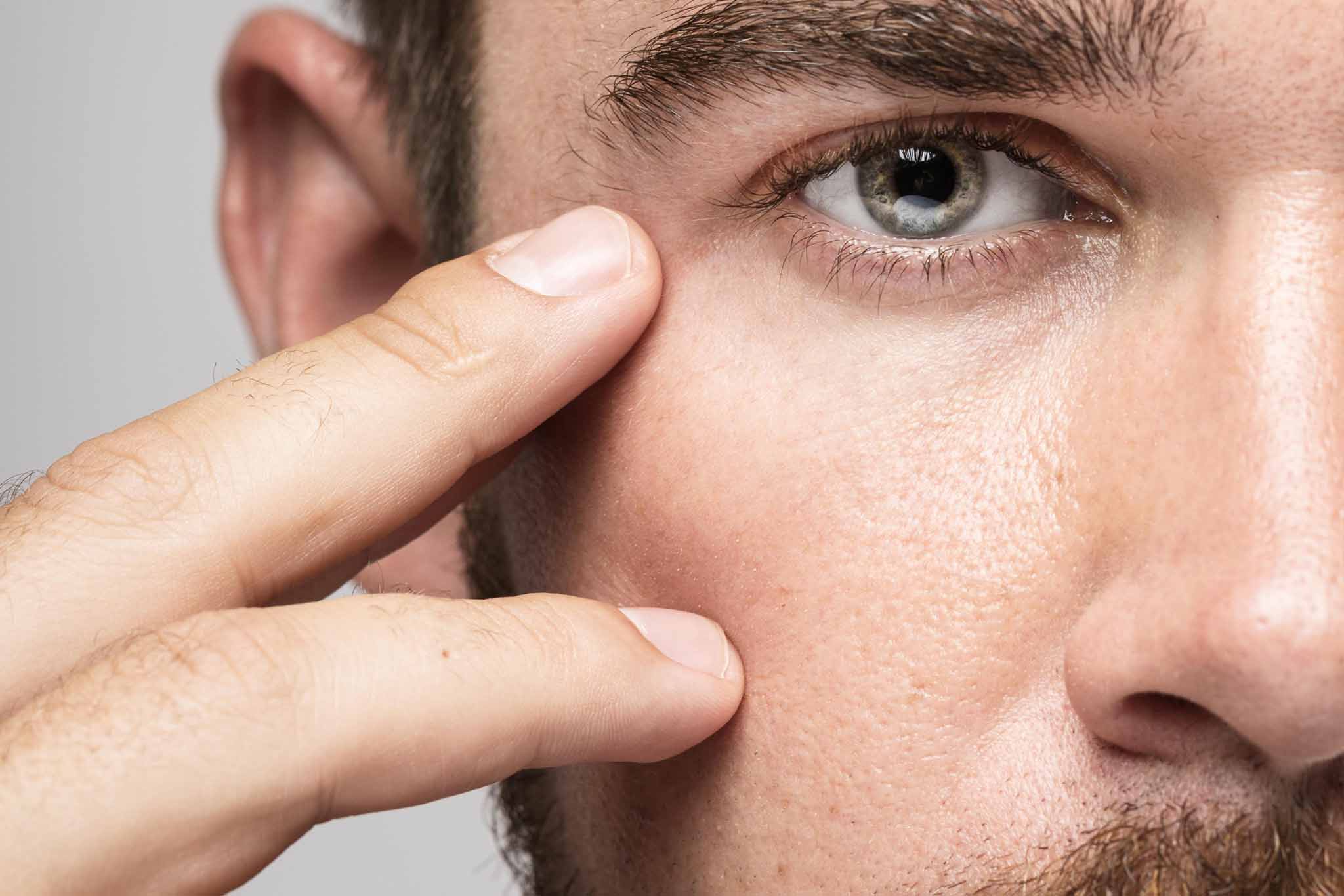 aumento de pomulos hombre