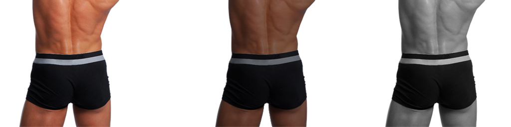 aumento de gluteos sin cirugia madrid