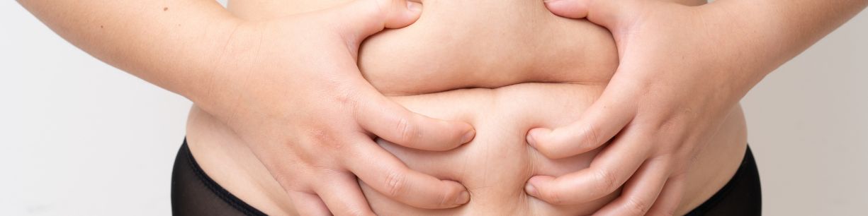 IPOSUCCIÓN SIN CIRUGÍA ANTES Y DESPUÉS: TODO LO QUE DEBES SABER