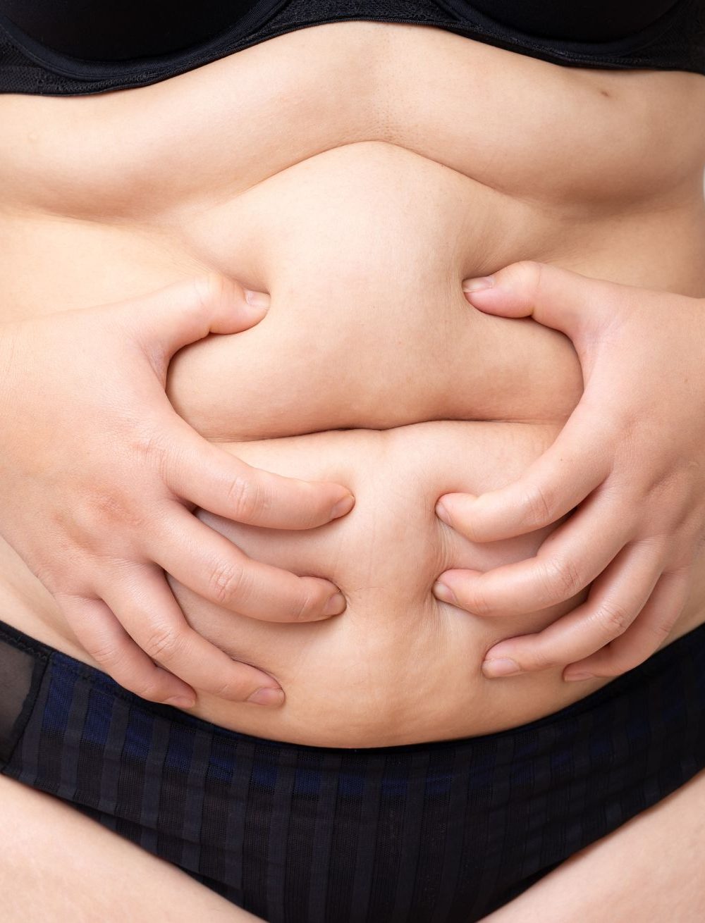 ULTRASONIDO ENFOCADO DE ALTA INTENSIDAD (HIFU) ULTRASONIDO ENFOCADO DE ALTA INTENSIDAD (HIFU)