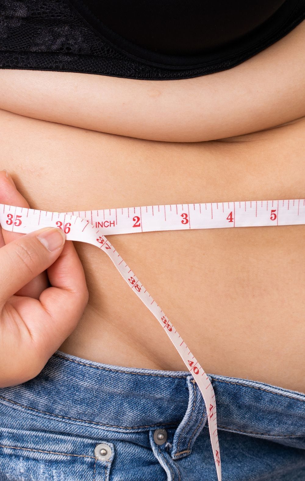 liposucción sin cirugía Madrid