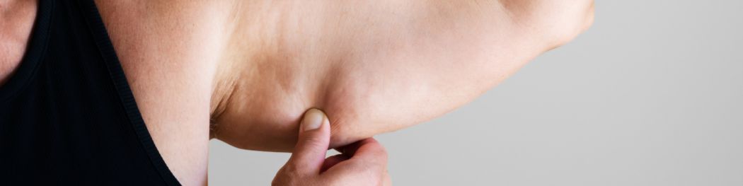 liposuccion sin cirugía ventajas