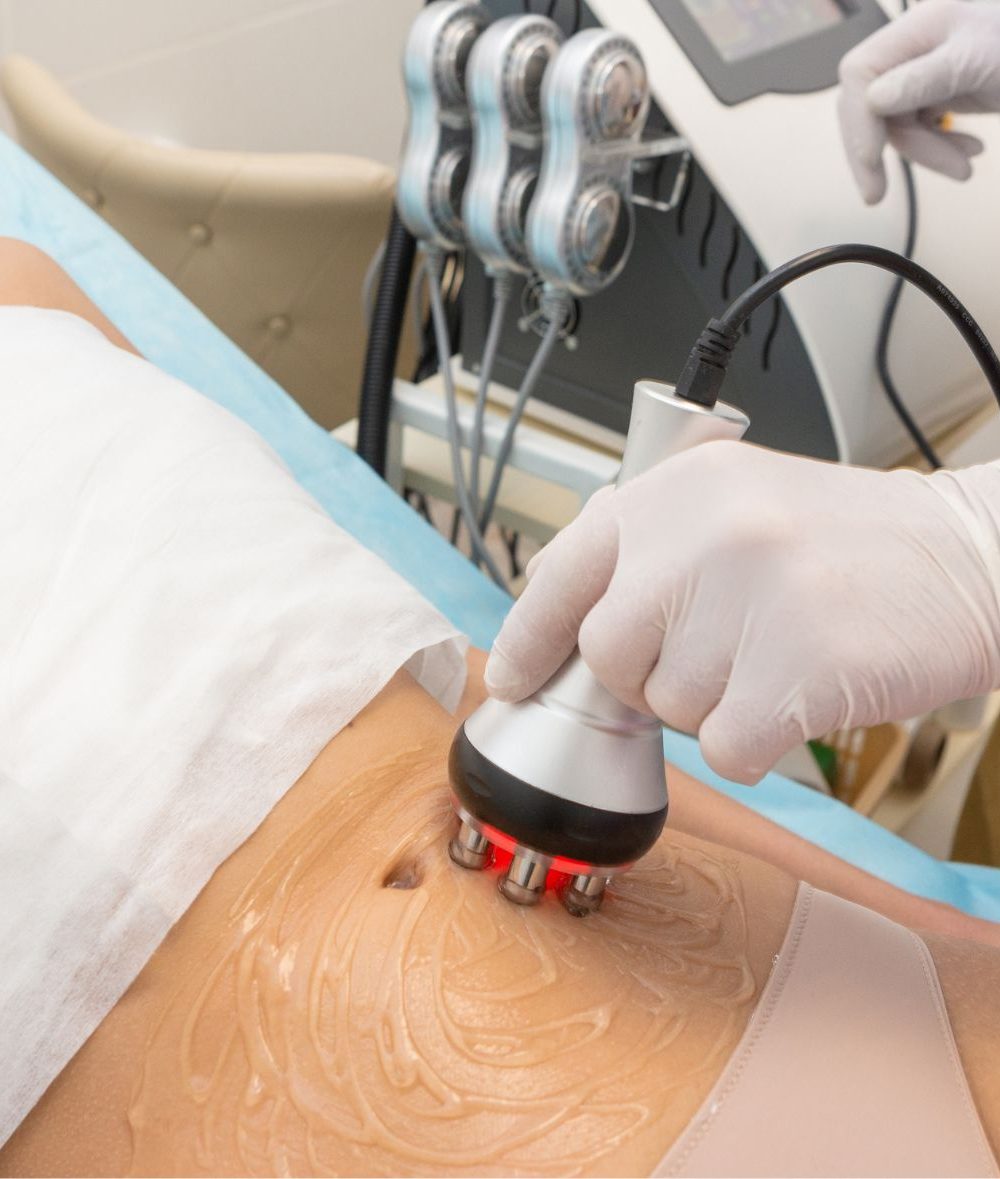 radiofrecuencia radiofrecuencia