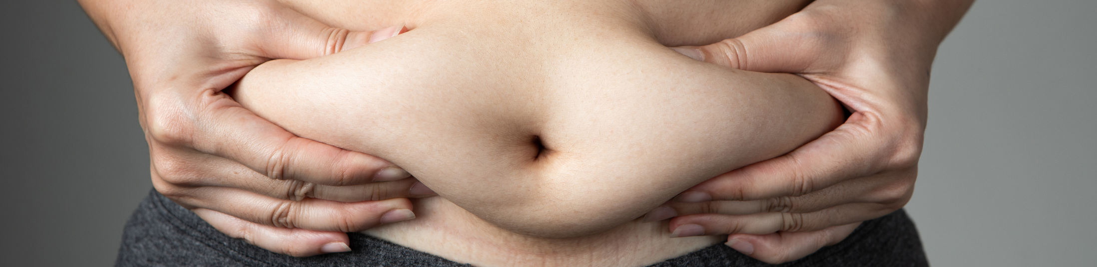 Liposucción sin cirugía Madrid