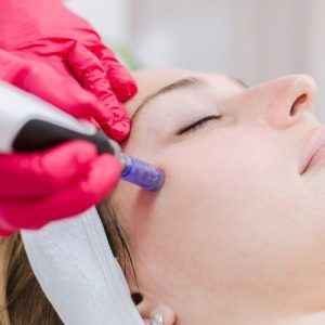 Dermapen Facial Madrid. Tratamiento de rejuvenecimiento facial en la Clínica de Medicina Estetica