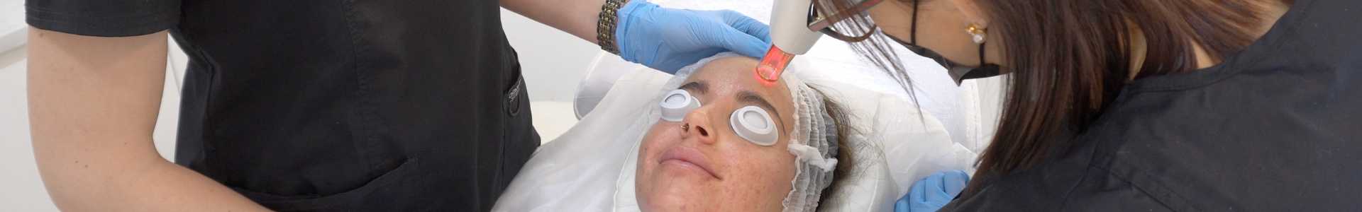 láser facial