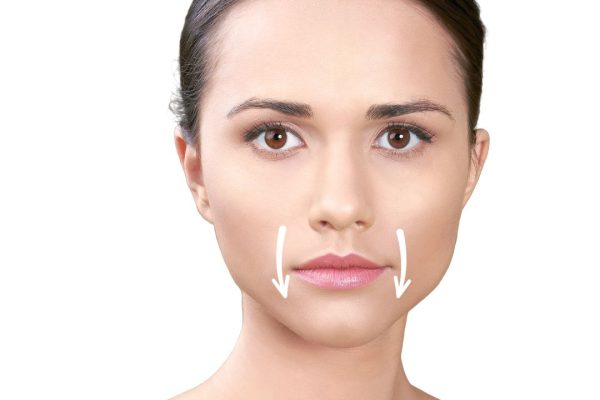 tratamiento líneas de marioneta en la clínica de medicina estetica Eb