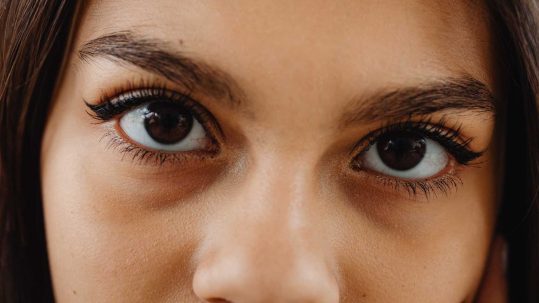 eliminar ojeras y bolsas Tratamiento de relleno de ojeras con acido hialuronico