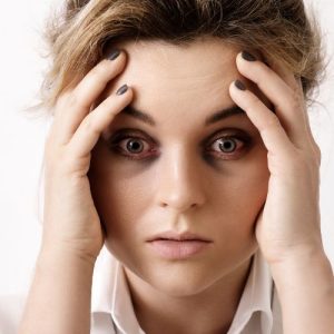 quitar las ojeras y bolsas de los ojos con medicina estética