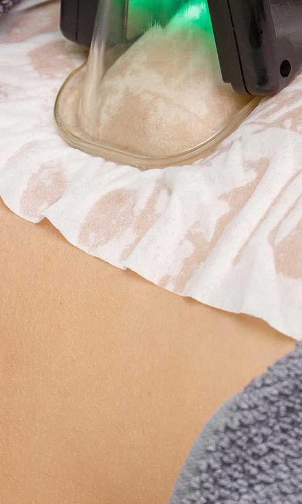 Criolipólisis es un tratamiento avanzado para eliminar la grasa localizada en la clínica de medicina estética de la Dra Elena Berezo