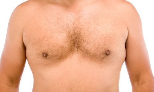 razones para acudir eliminar grasa pectoral