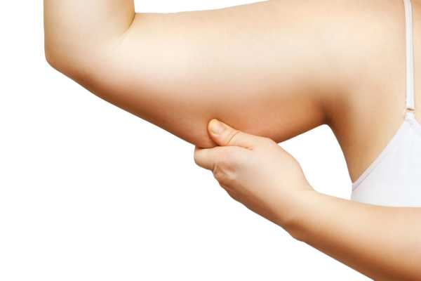 coolsculpting para brazos coolsculpting-brazos