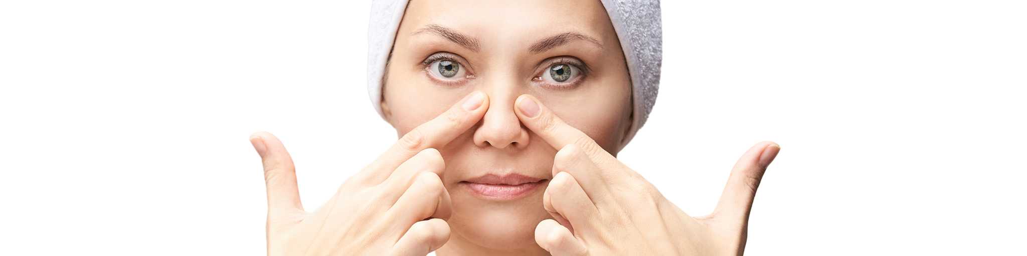 tratamiento bunny lines con botox en la clínica de medicina estética de la Dra Elena Berezo