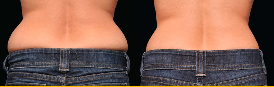 eliminar grasa cintura