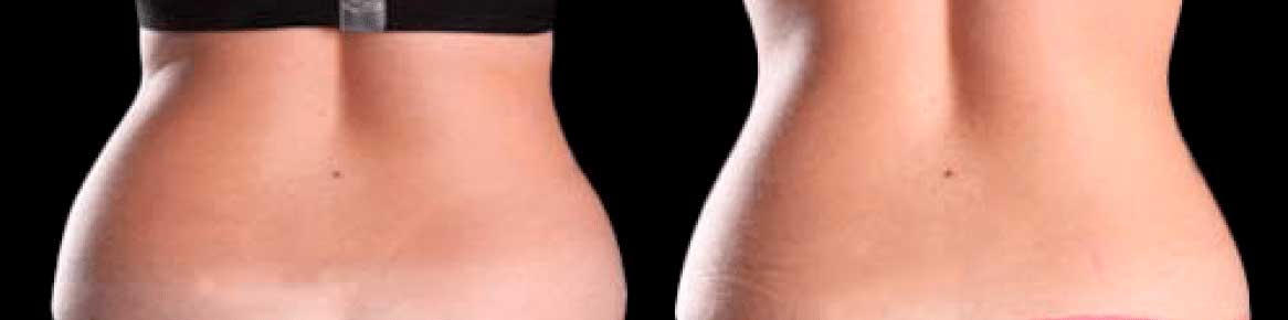 eliminar grasa cintura