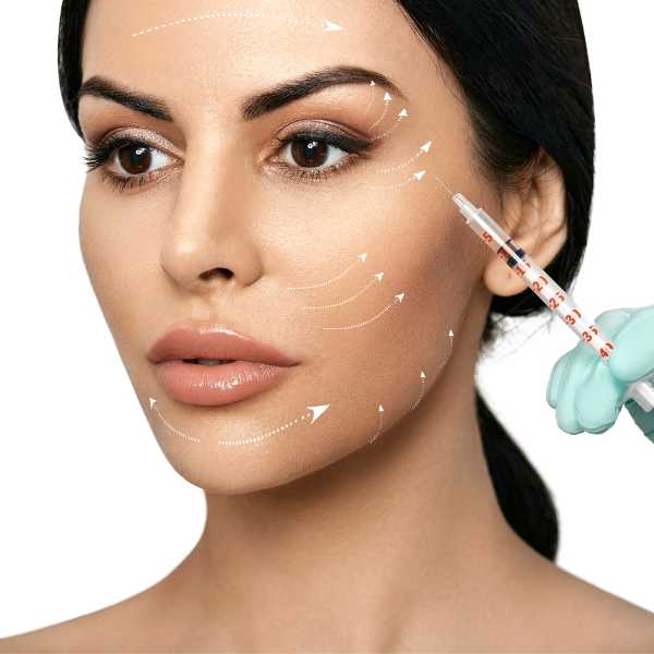 ellanse para el lifting facial sin cirugía