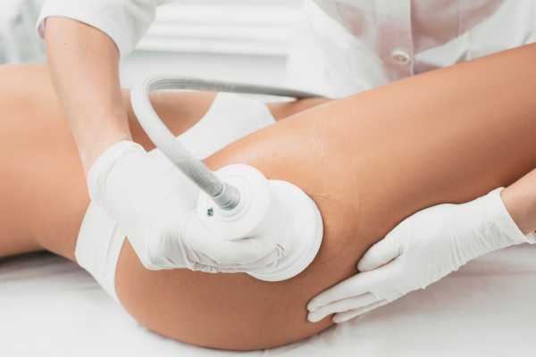 tratamiento intralipoterapia para eliminar grasa en la clínica de medicina estética Dra Elena Berezo