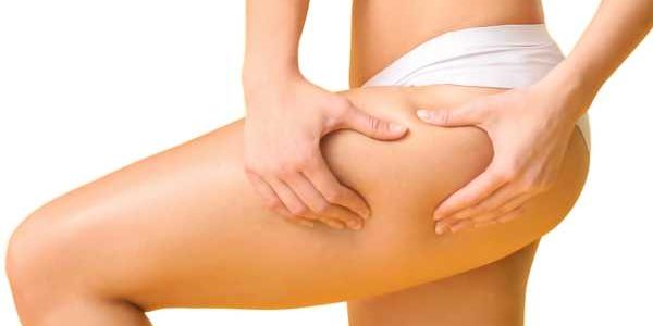 tratamientos coolsculpting para eliminar grasa en la clínica de medicina estética Dra Elena Berezo