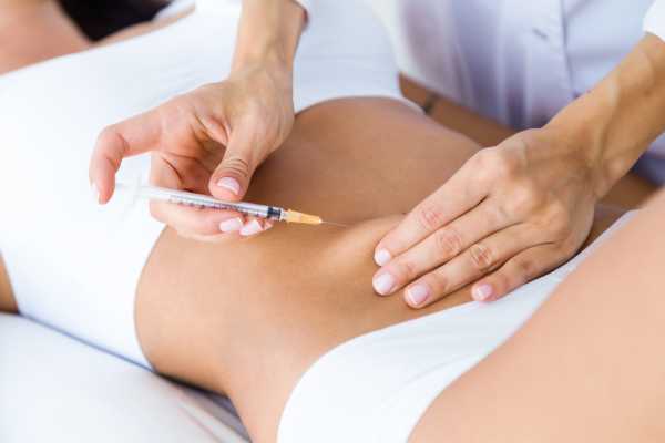 ¿Qué es la mesoterapia corporal?