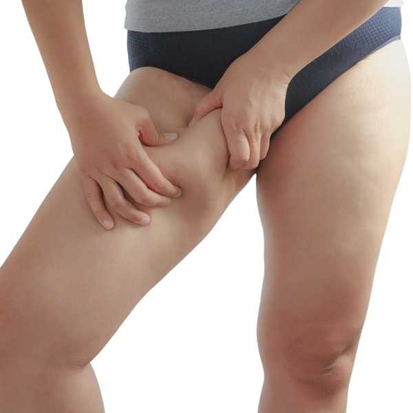 se puede realizar coolsculpting piernas