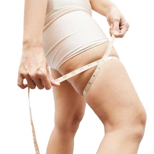 Ventajas del tratamiento coolsculpting piernas
