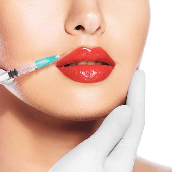 cuando se ven los resultados del lip lift