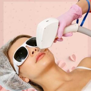 Laser facial. resurfacing láser facial en la clínica de medicina estetica EB, dirigida por la Dra Elena Berezo