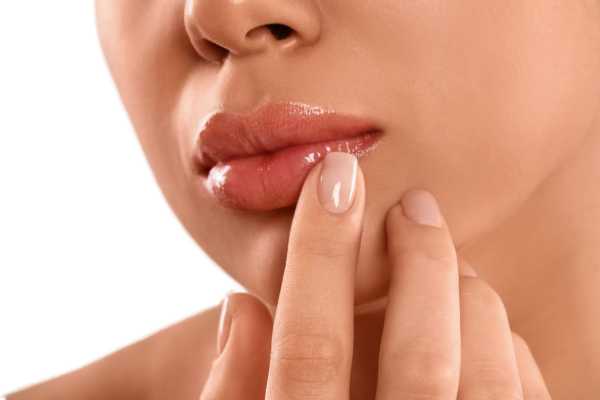 Lip lift sin Cirugía. que es un lip lift