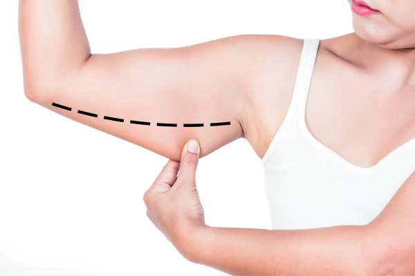 importancia de reducir grasa localizada en madrid