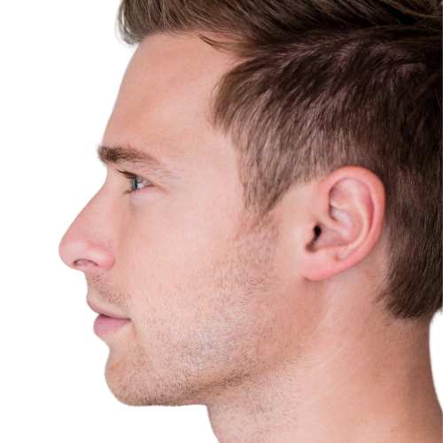 precio marcación mandibular hombre en Madrid medicina estética Doctora Elena berezo